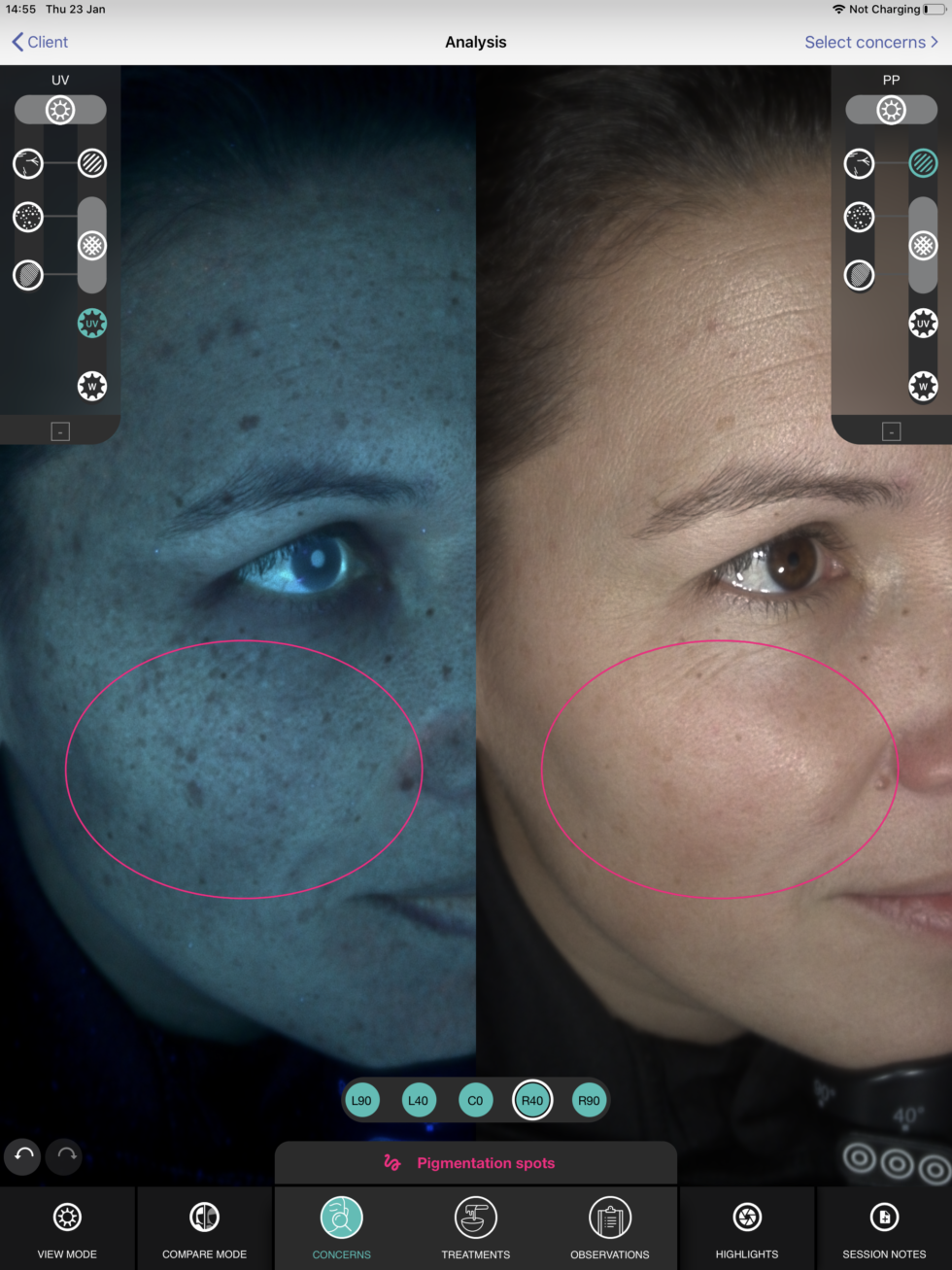 Skin analysis - Mana Skin Body & Soul